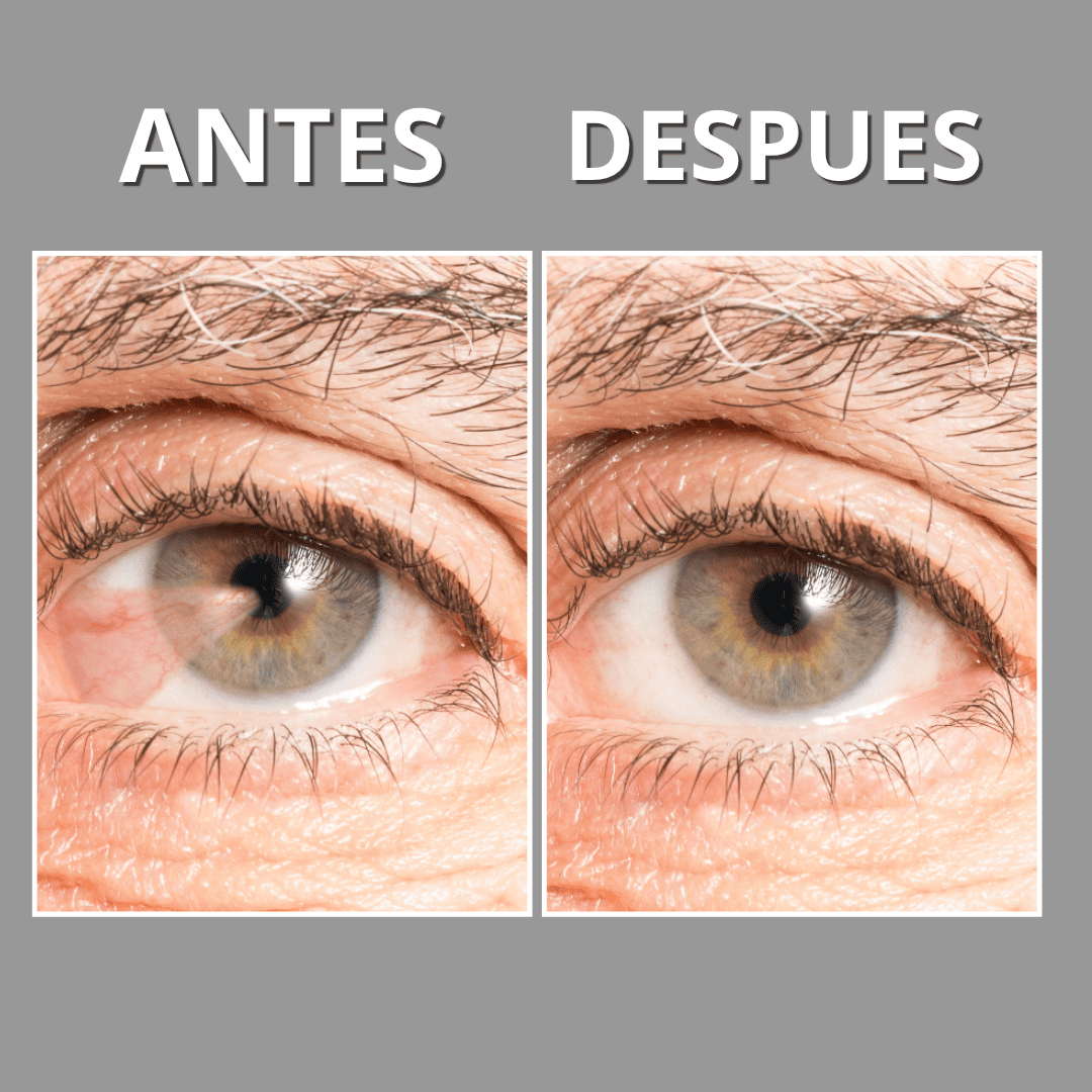 Oftalmiel™ Tratamiento Ocular Homeopatico 100% Natural