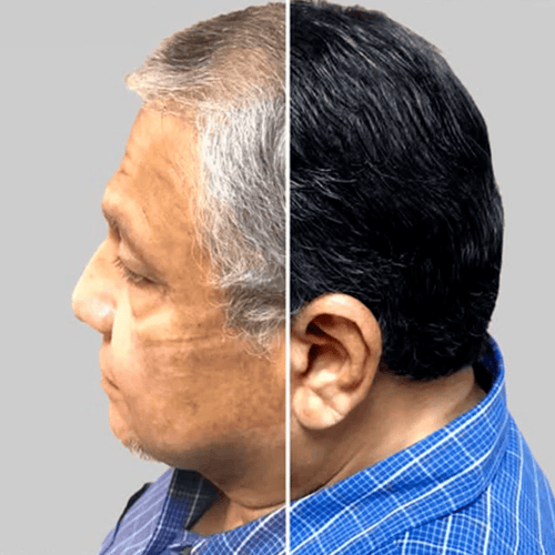 Jorge Eliécer Mendoza, 63 Años