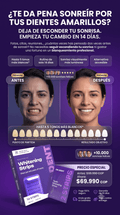 Tratamiento para blanqueamiento dental de 14 dias (ASEGURADO)