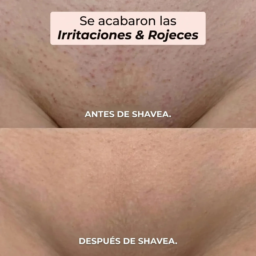 SHAVERA™ - AFEITADORA FEMENINA PARA CUERPO Y BIKINI