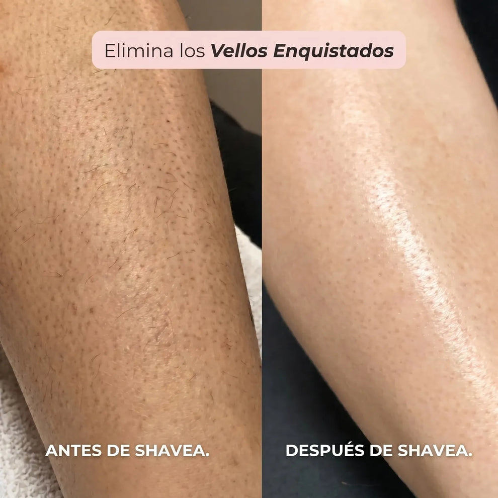SHAVERA™ - AFEITADORA FEMENINA PARA CUERPO Y BIKINI